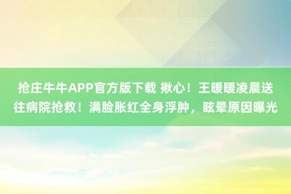 抢庄牛牛APP官方版下载 揪心！王暖暖凌晨送往病院抢救！满脸胀红全身浮肿，眩晕原因曝光